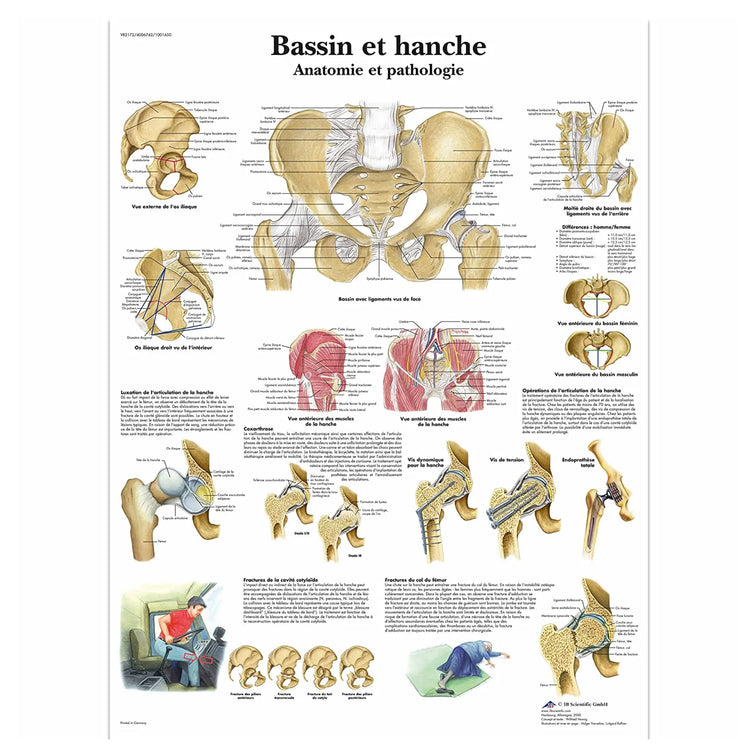 Planche anatomique - Bassin et hanche - Anatomie et pathologie - 3B Scientific - My Podologie